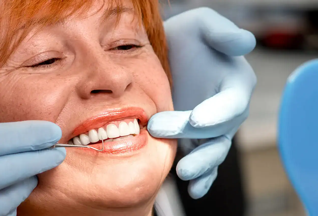 Full and Partial Dentures in Burlingame, CA
