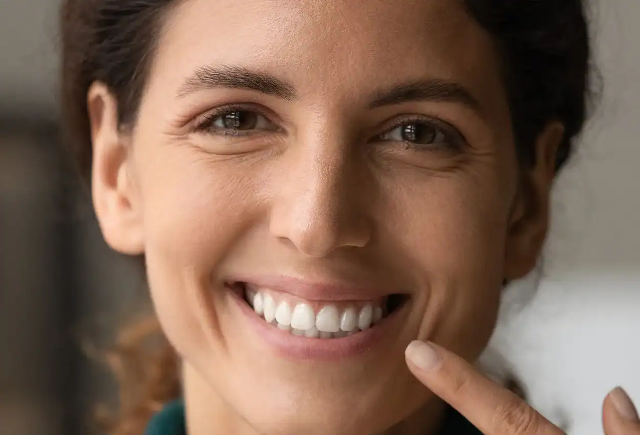 Dental Bonding in Burlingame, CA